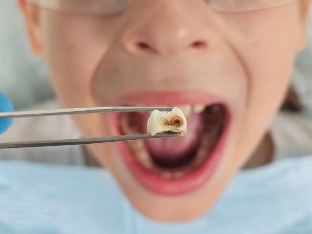 Best Emergency Dentist for Knocked-Out Tooth in Rio Linda, CA